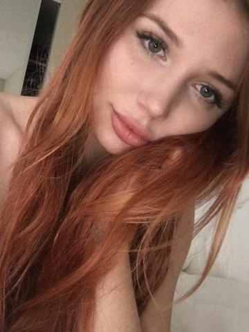 Альбина